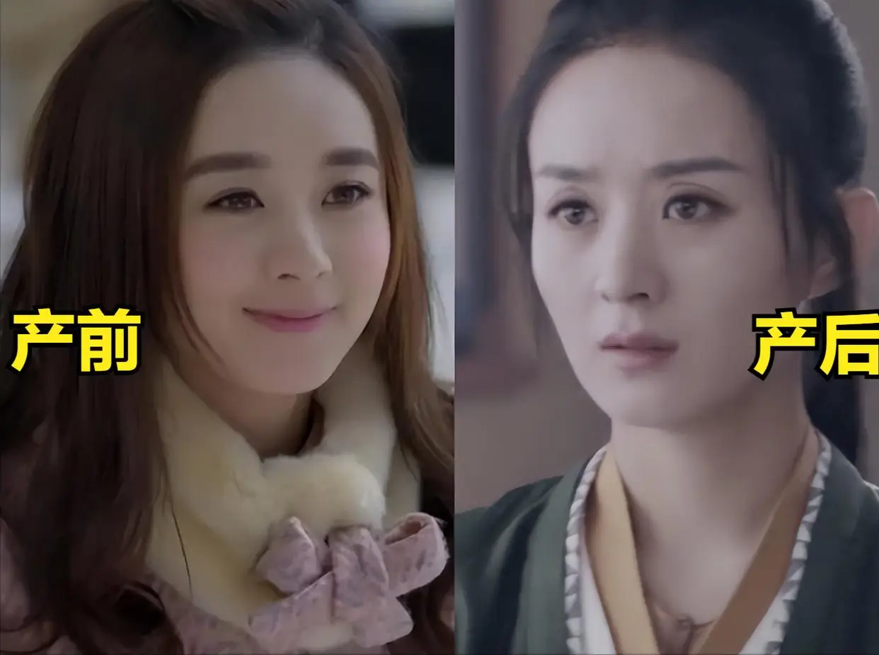 女明星脱发严重_发量少的女明星有哪些_杨幂赵丽颖金晨假发片